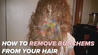 How this mom removed Bunchems from daughters hair [upl. by Eihcir80]