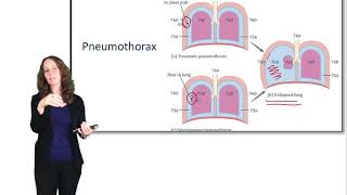 Mechanical Ventilation [upl. by Charlean]