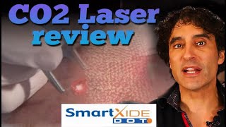 CO2 LASER REVIEW  Glass Skin [upl. by Airun]