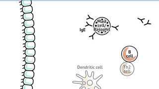 Mecanismo de acción de la enfermedad alérgica [upl. by Eninahpets]