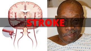 Stroke Rehabilitation at Helen Hayes Hospital Part Two [upl. by Cas]