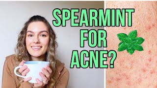 I Drank Spearmint Tea For 30 Days To Heal Hormonal Acne Before and After [upl. by Gnivre]