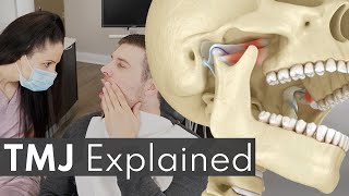 TMJ Explained  Jaw Pain Causes amp Symptoms [upl. by Renita537]