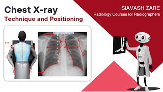 Approach to Pediatric Chest XRays [upl. by Pestana]