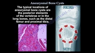 Anatomy of Thyroid and Parathyroid Glands  Dr Ahmed Farid [upl. by Etnovaj]