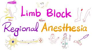 Limb Block  Peripheral Nerve Block  Regional anesthesia [upl. by Epifano]