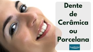 Dente Cerâmica ou Porcelana [upl. by Sihtam]