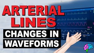 Common Changes in Arterial Line Waveforms [upl. by Nanyk945]