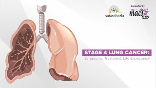 What is Subarachnoid Haemorrhage  Clinical Anatomy [upl. by Male]