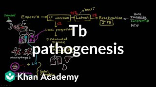 TB pathogenesis  Infectious diseases  NCLEXRN  Khan Academy [upl. by Malamut222]