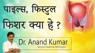 Hi9  पाइल्स फिस्टुलाफिशर क्या है  Dr  Ananda kumar Gastroenterologist [upl. by Rochester]