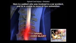 Spinal Cord Injury Detailed  Everything You Need To Know  Dr Nabil Ebraheim [upl. by Paris]