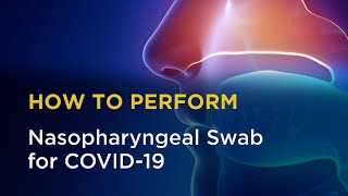 Nasopharyngeal Swab for COVID19 [upl. by Skelly]