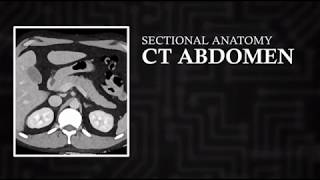 CT Cross Sectional Anatomy Abdomen Axial View [upl. by Cullin]