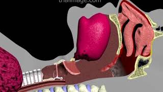 Endotracheal Intubation Animation by Cal Shipley MD [upl. by Player]