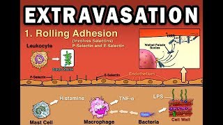 EXTRAVASATION [upl. by Yelsnya]