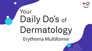 Erythema Multiforme  Daily Dos of Dermatology [upl. by Vance]