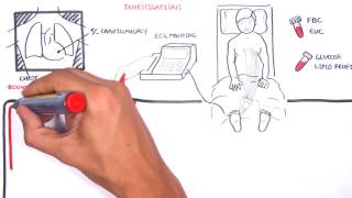 Acute Coronary Syndrome DETAILED Overview MI STEMI NSTEMI [upl. by Elleira]