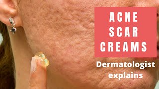 Acne Scar Creams  Dermatologist Reviews [upl. by Campball]