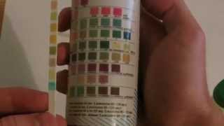 How to perform Urinalysis [upl. by Licastro15]