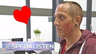 Herzförmige Verbrennung im Gesicht wie ist das passiert  Die Spezialisten  SAT1 TV [upl. by Steffen]