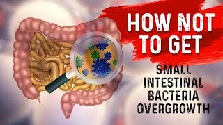 Bowel Obstruction  Causes and Pathophysiology [upl. by Yednil]