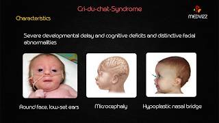 CriduChat Syndrome  Usmle step 1 lecture [upl. by Jerrylee631]