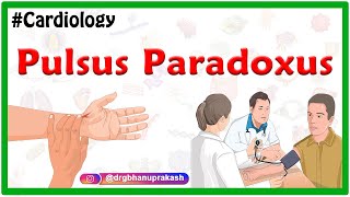 Pulsus Paradoxus  Examination of the arterial pulse  Cardiology USMLE [upl. by Dott]