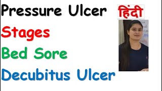 Pressure Ulcer  Stages of Pressure Ulcer  Bed Sores  Decubitus Ulcer  RajNEET Medical Education [upl. by Naltiak]