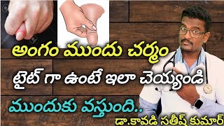 Mouth Ulcers Reasons and Treatment in Telugu [upl. by Caz]