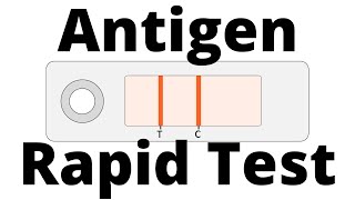 How SARSCoV2 Antigen Rapid Tests work Covid19 Testing [upl. by Ailegna95]