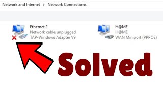 Network cable unplugged error in Windows 10  11 Fix [upl. by Loram]