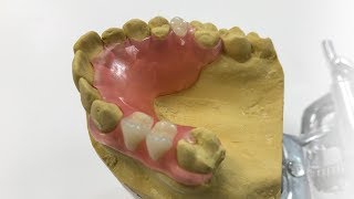 How To Make A Fiber Flex™ Partial  The Entire Process  Dental Lab Learning [upl. by Philbrook951]