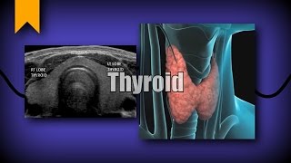 Thyroid Ultrasound [upl. by Leverick650]