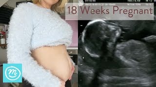 18 Weeks Pregnant What You Need To Know  Channel Mum [upl. by Naeerb]