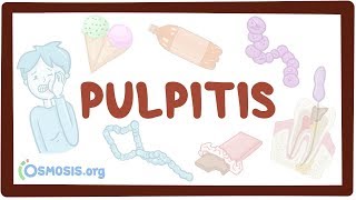 Pulpitis  causes symptoms diagnosis treatment pathology [upl. by Namyl]