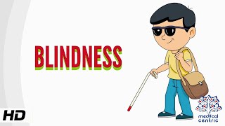 Blindness Causes Signs and Symptoms Diagnosis and Treatment [upl. by Kaycee]