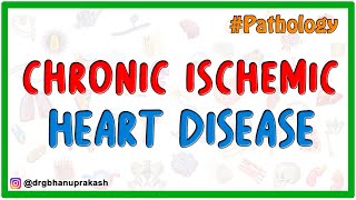 Chronic Ischemic Heart Disease  Pathology USMLE Step 1 [upl. by Etak]