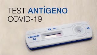 Test Antígeno COVID19 Clínica CEMTRO [upl. by Enylodnewg]