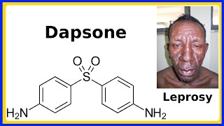 Examining Bartonella [upl. by Yenaled]