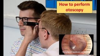 How to perform Otoscopy Ear Exam [upl. by Ddarb]