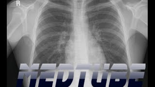 How to read a Chest Radiograph easily [upl. by Owens]