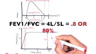 Understanding Spirometry  Normal Obstructive vs Restrictive [upl. by Eugaet750]