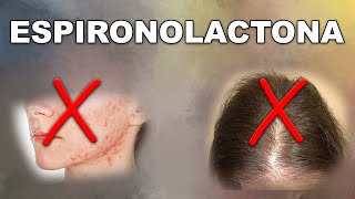 ESPIRONOLACTONA ¿solución ACNÉ y ALOPECIA femenina [upl. by Galitea207]