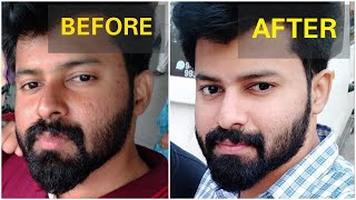 Get brighter skin Naturally in 2 Weeks  No side effects  Tamil  shadhikazeez [upl. by Bailie]