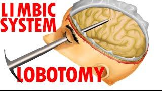 Limbic System Anatomy  Lobotomy And Human Emotions [upl. by Ierdna]