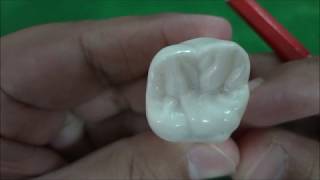 Maxillary Permanent First Molar Morphology [upl. by Yelbmik]