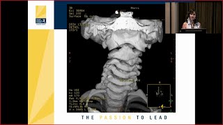 Lateral to Medial Radial Head Mobilization for Supination [upl. by Cassady]