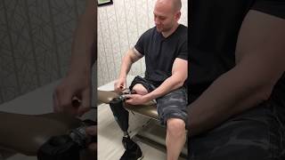 Osseointegration Limb Replacement Patient Jesse Levine  HSS [upl. by Eatnoj]