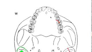 DYNAMIC OCCLUSION  Working vs Nonworking Movement amp Occlusal Grid [upl. by Enetsuj]